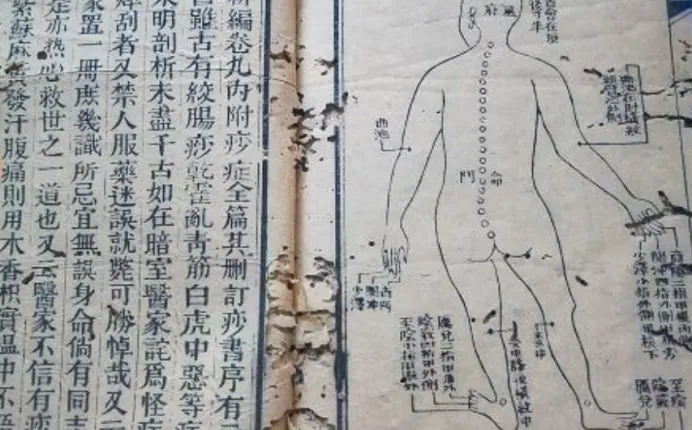 痧在气则刮，痧在血则泄